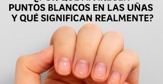 Puntos blancos en las uñas